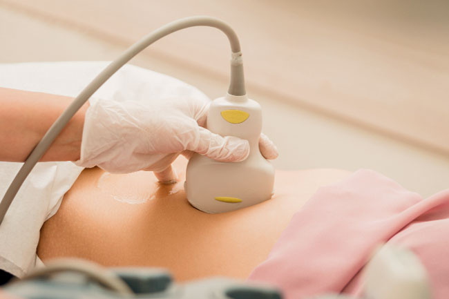 Bassa Riserva Ovarica -Quali strategie - Dr.ssa Chiara Granato Embriologa