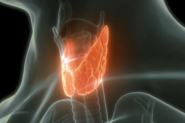 Ipertiroidismo autoimmune e Bassa Motilità Spermatica. Un problema di coppia - Dr.ssa Chiara Granato