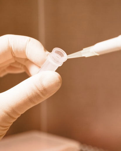 Ipertiroidismo autoimmune e Bassa Motilità Spermatica. Un problema di coppia - Dr.ssa Chiara Granato