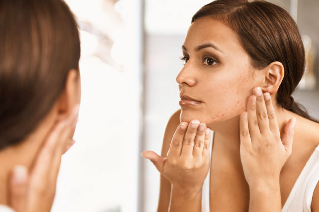 Olga: Dall'Ovaio Policistico alla Stimolazione per la PMA - Dr.ssa-Chiara-Granato