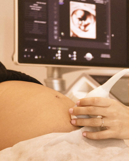 Olga: Dall'Ovaio Policistico alla Stimolazione per la PMA - Dr.ssa-Chiara-Granato